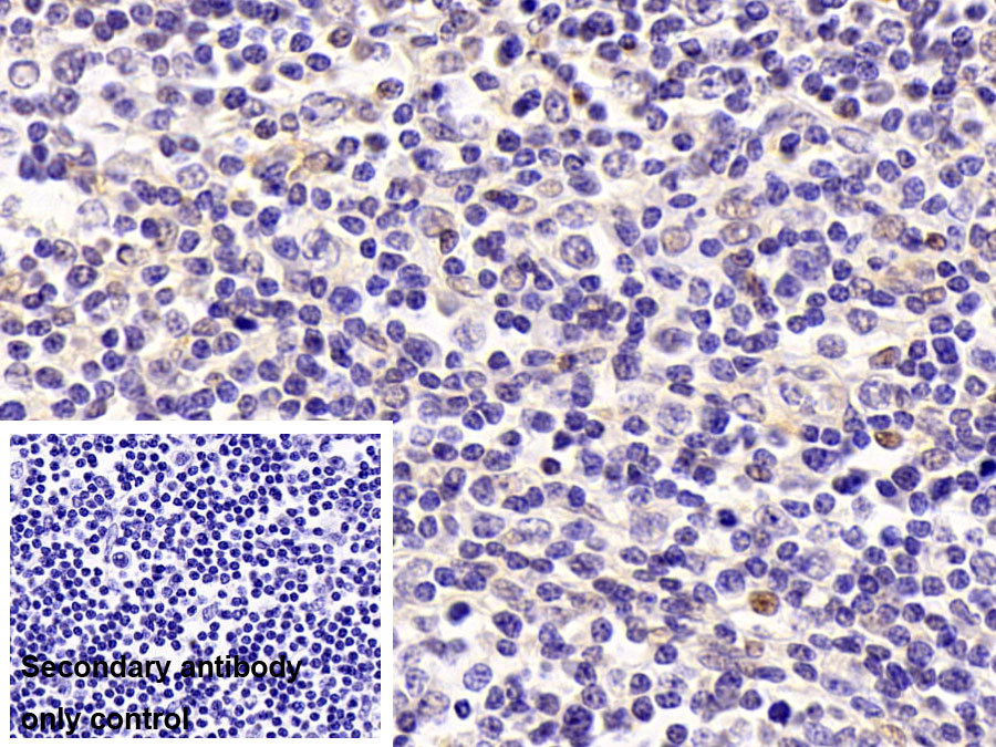 Polyclonal Antibody to Tumor Protein p53 (P53)