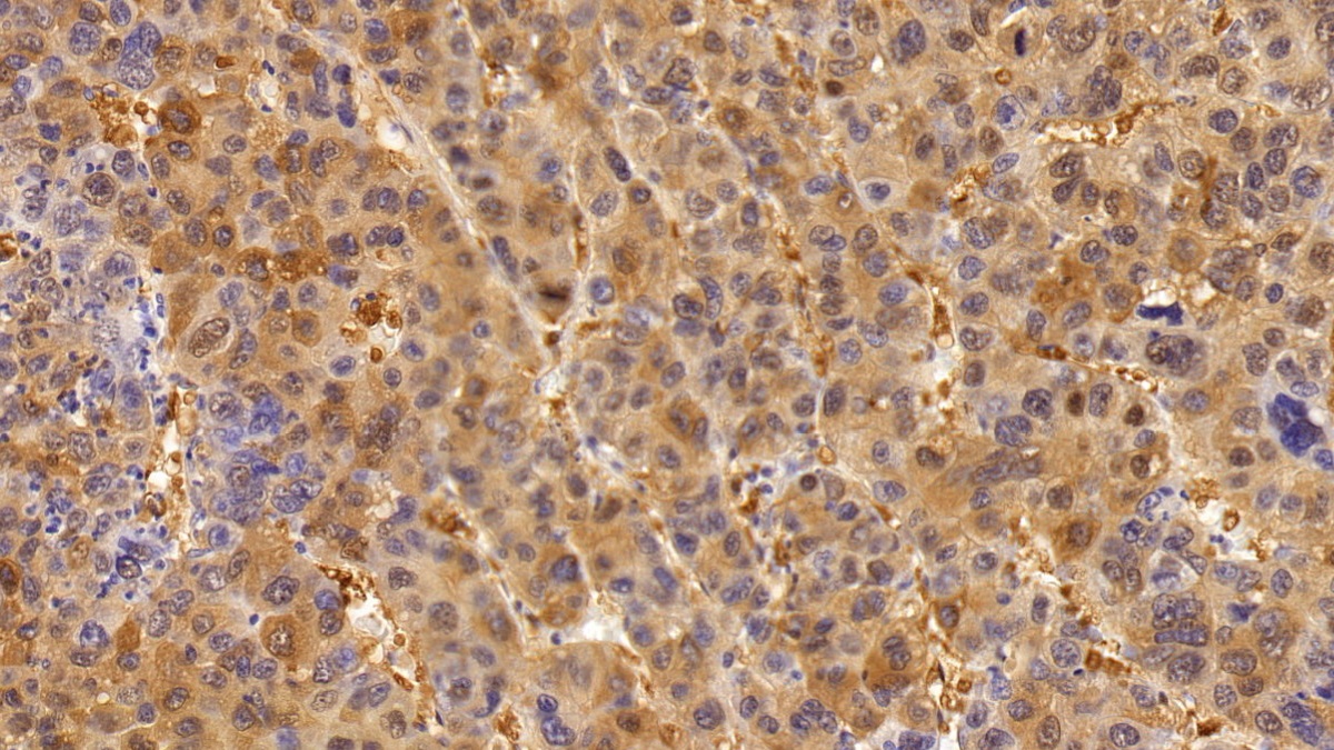 Polyclonal Antibody to Tumor Protein p53 (P53)