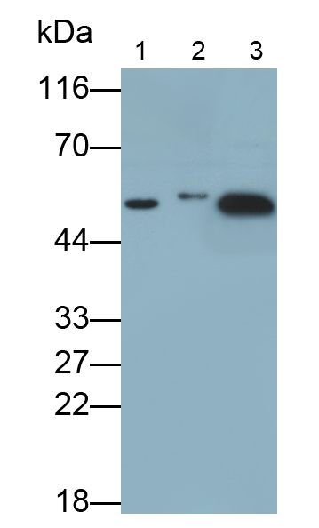 Polyclonal Antibody to Tumor Protein p53 (P53)