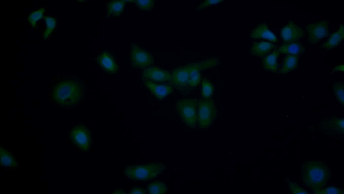 Polyclonal Antibody to Tumor Protein p53 (P53)