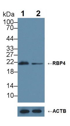 Polyclonal Antibody to Retinol Binding Protein 4 (RBP4)