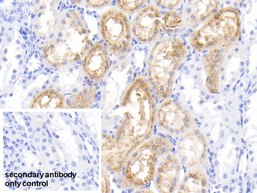 Polyclonal Antibody to Retinol Binding Protein 4 (RBP4)