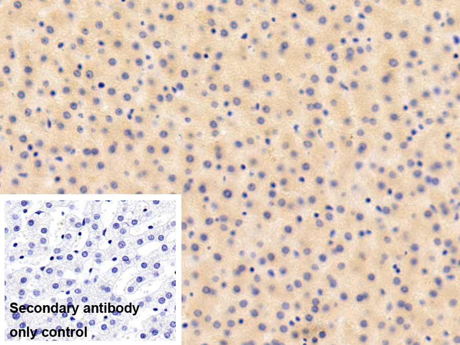 Polyclonal Antibody to Retinol Binding Protein 4 (RBP4)