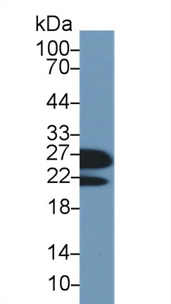 Polyclonal Antibody to Retinol Binding Protein 4 (RBP4)