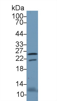 Polyclonal Antibody to Retinol Binding Protein 4 (RBP4)