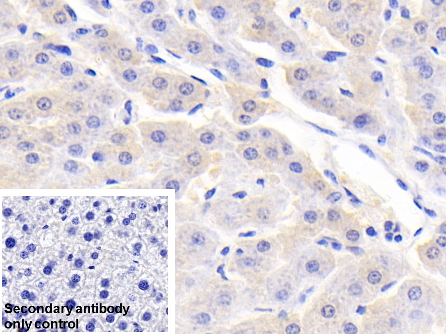 Polyclonal Antibody to Retinol Binding Protein 4 (RBP4)