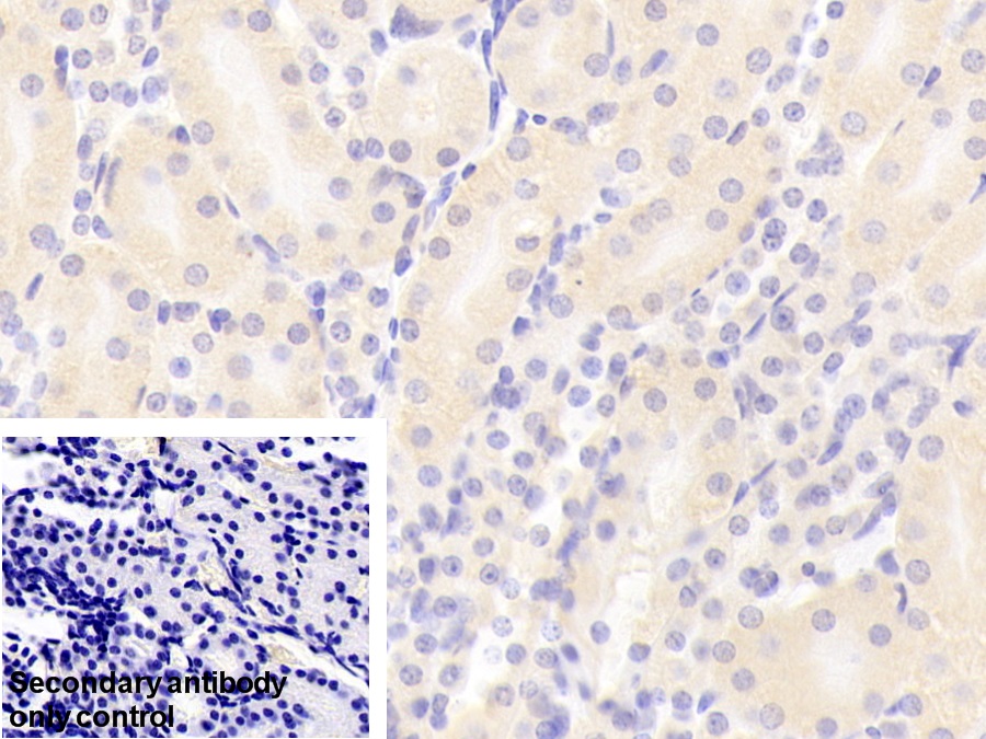 Polyclonal Antibody to Retinol Binding Protein 4 (RBP4)