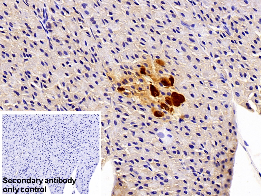 Polyclonal Antibody to Retinol Binding Protein 4 (RBP4)