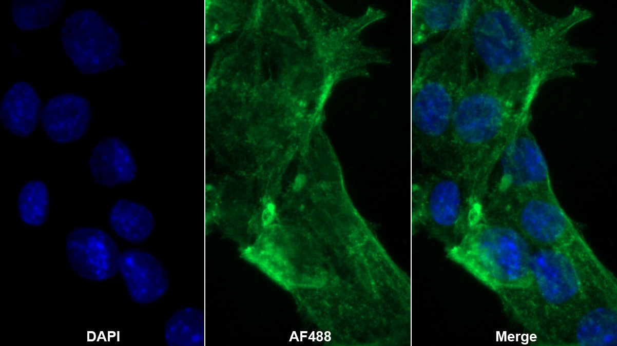 Polyclonal Antibody to Retinol Binding Protein 4 (RBP4)