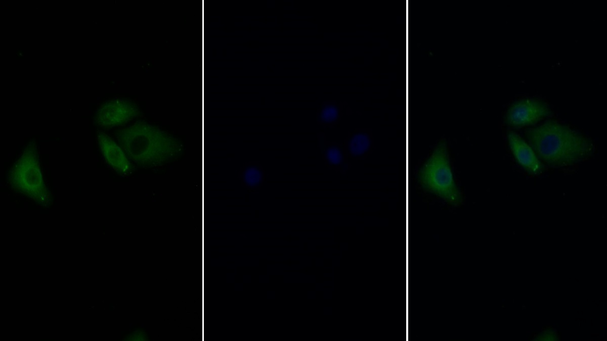 Polyclonal Antibody to Extracellular Signal Regulated Kinase 2 (ERK2)