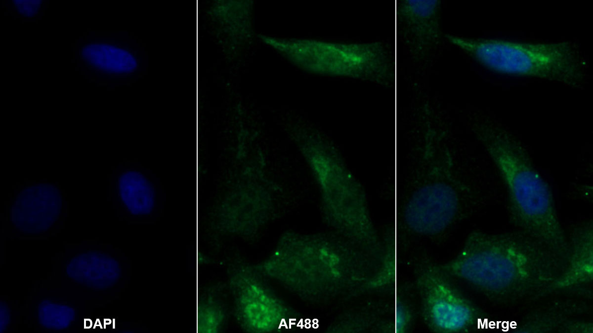 Polyclonal Antibody to Extracellular Signal Regulated Kinase 2 (ERK2)