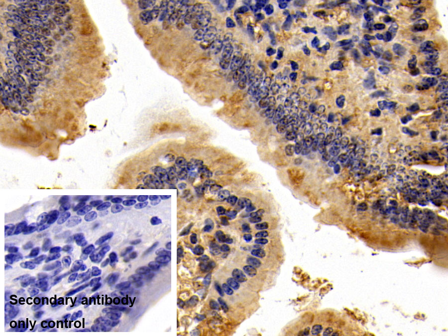 Polyclonal Antibody to Extracellular Signal Regulated Kinase 2 (ERK2)