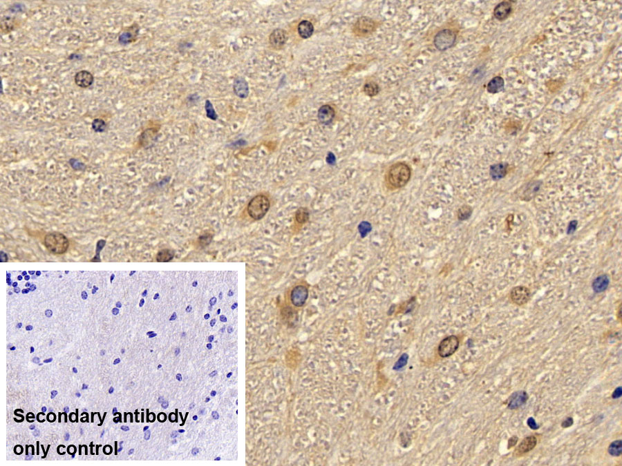 Polyclonal Antibody to Extracellular Signal Regulated Kinase 2 (ERK2)