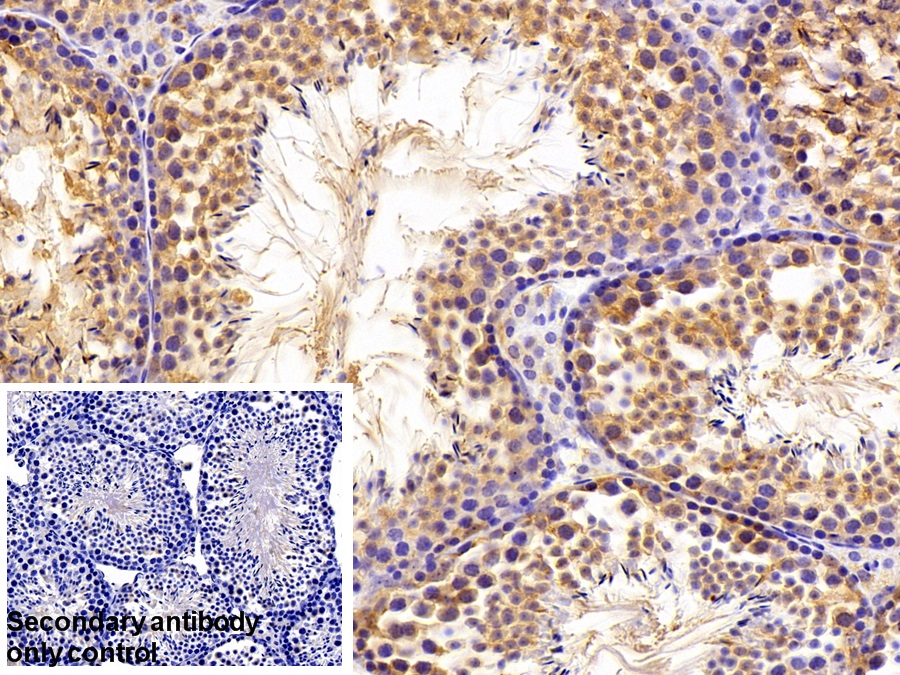 Polyclonal Antibody to Protein Interacting With C Kinase 1 (PICK1)