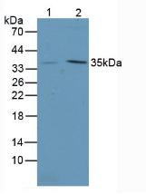 Polyclonal Antibody to Intelectin 1 (ITLN1)