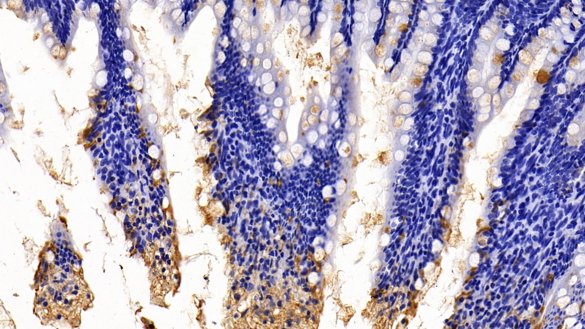 Polyclonal Antibody to Intelectin 1 (ITLN1)