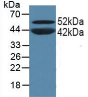 Polyclonal Antibody to Peroxisome Proliferator Activated Receptor Alpha (PPARa)