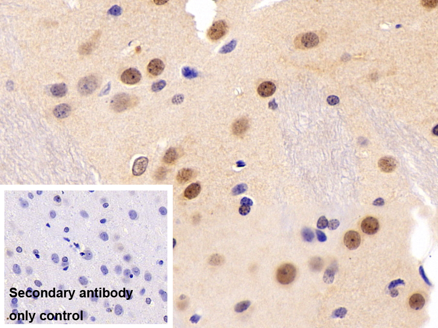 Polyclonal Antibody to Peroxisome Proliferator Activated Receptor Alpha (PPARa)