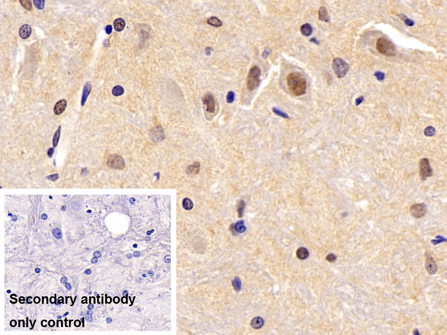 Polyclonal Antibody to Peroxisome Proliferator Activated Receptor Alpha (PPARa)