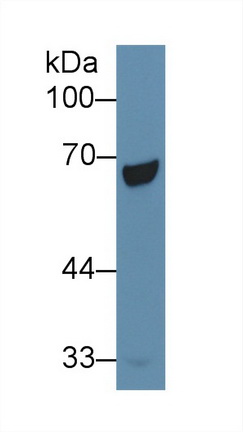 Polyclonal Antibody to Phosphoenolpyruvate Carboxykinase 1, Soluble (PCK1)