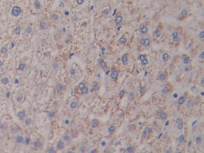 Polyclonal Antibody to Nephrin (NPHN)