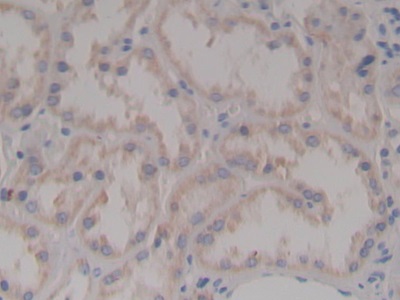 Polyclonal Antibody to Nephrin (NPHN)