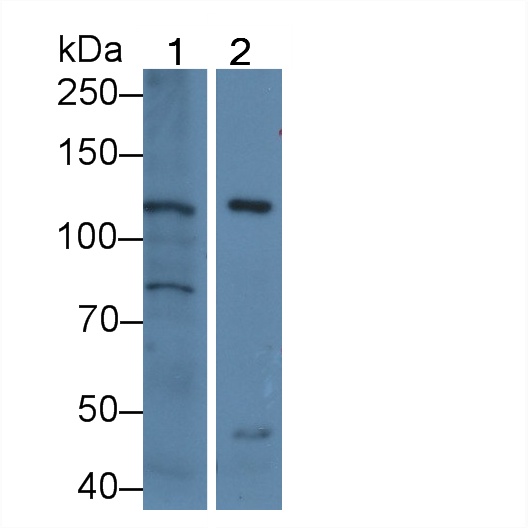 Polyclonal Antibody to Nephrin (NPHN)