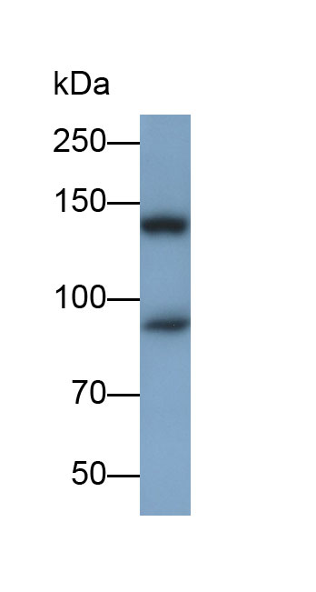 Polyclonal Antibody to Nephrin (NPHN)