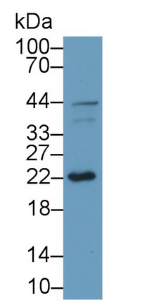 Polyclonal Antibody to Gamma-synuclein (SNCG)