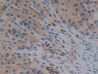 Polyclonal Antibody to Gamma-synuclein (SNCG)