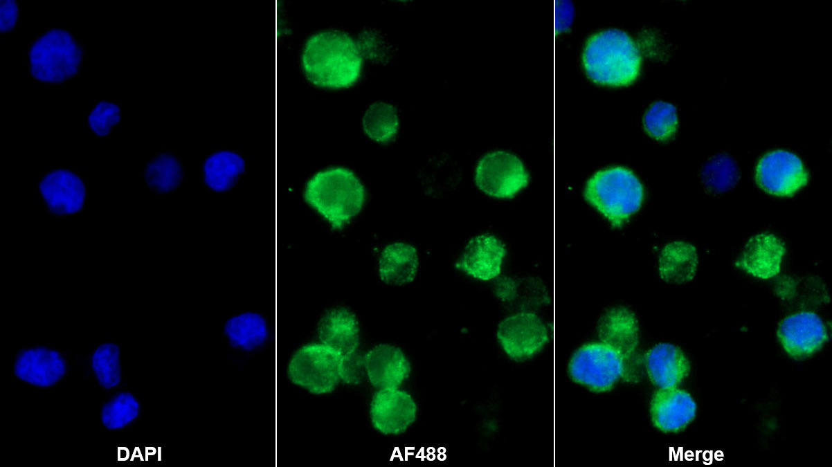 Polyclonal Antibody to Chemokine C-X-C-Motif Receptor 4 (CXCR4)