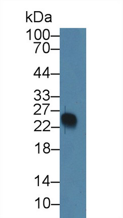 Polyclonal Antibody to Pre-B-Lymphocyte Gene 1 (VPREB1)