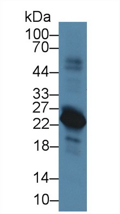 Polyclonal Antibody to Pre-B-Lymphocyte Gene 1 (VPREB1)