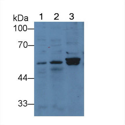 Polyclonal Antibody to Thymidine Phosphorylase (TP)