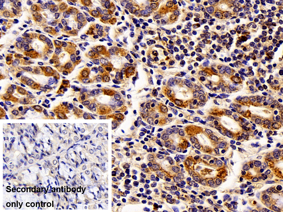 Polyclonal Antibody to Thymidine Phosphorylase (TP)