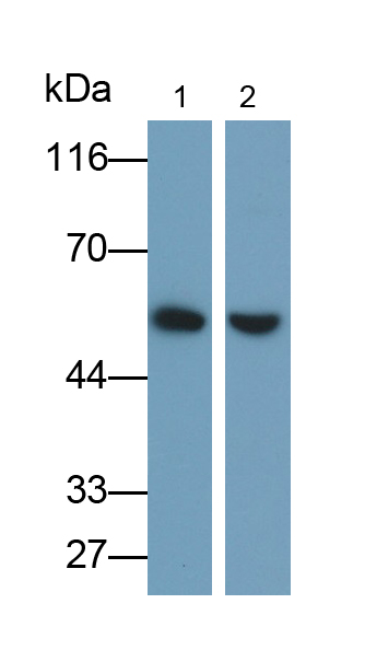 Polyclonal Antibody to Thymidine Phosphorylase (TP)