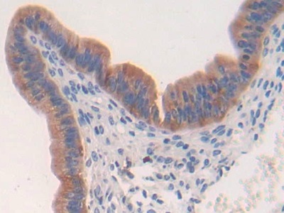 Polyclonal Antibody to Thymidine Phosphorylase (TP)