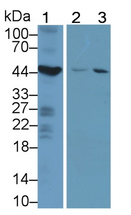 Polyclonal Antibody to Thymidine Phosphorylase (TP)