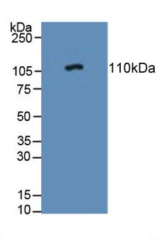 Polyclonal Antibody to Protein Tyrosine Phosphatase Receptor Type N (PTPRN)