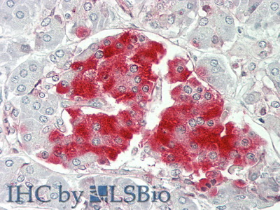 Polyclonal Antibody to Protein Tyrosine Phosphatase Receptor Type N (PTPRN)