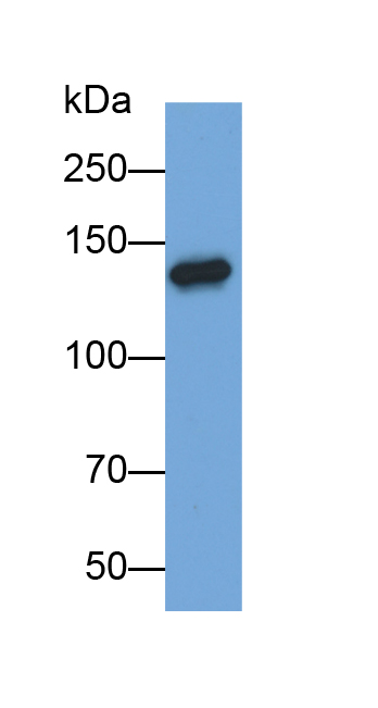 Polyclonal Antibody to Procollagen I N-Terminal Propeptide (PINP)