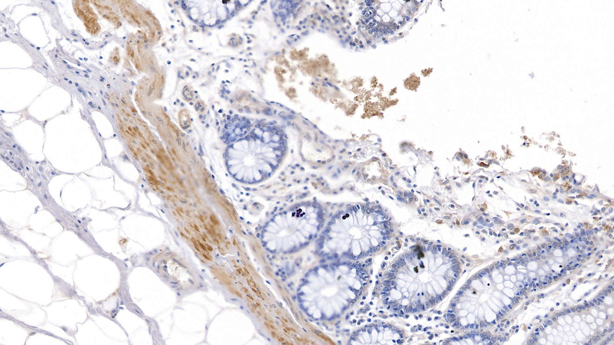 Polyclonal Antibody to Pyruvate Dehydrogenase Kinase 4 (PDK4)