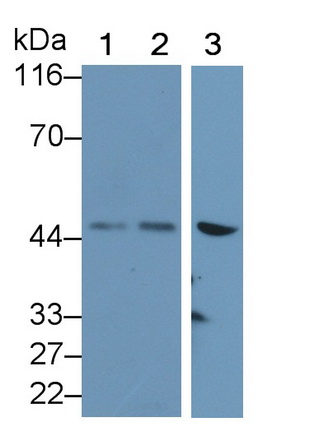 Polyclonal Antibody to Pyruvate Dehydrogenase Kinase 4 (PDK4)