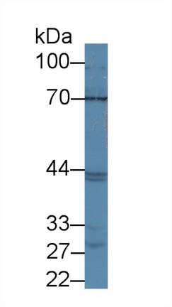 Polyclonal Antibody to ATP Binding Cassette Transporter G2 (ABCG2)