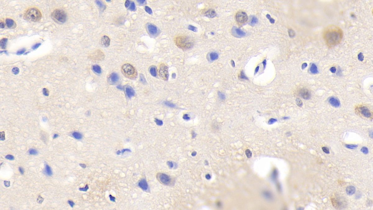 Polyclonal Antibody to Sialic Acid Binding Ig Like Lectin 5 (SIGLEC5)