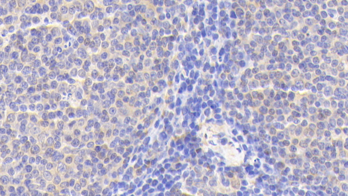 Polyclonal Antibody to Sialic Acid Binding Ig Like Lectin 5 (SIGLEC5)