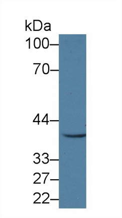 Polyclonal Antibody to Centaurin Alpha 1 (CENTa1)