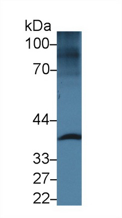 Polyclonal Antibody to Centaurin Alpha 1 (CENTa1)