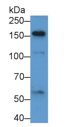 Polyclonal Antibody to Alpha-2-Macroglobulin Like Protein 1 (a2ML1)