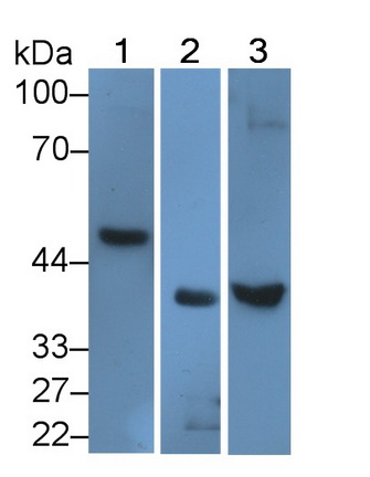 Polyclonal Antibody to Activin A Receptor Type I (ACVR1)